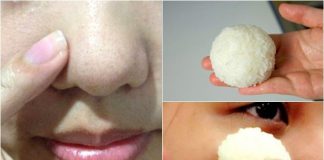 5 MẶT NẠ THIÊN NHIÊN TRỊ MỤN ĐẦU ĐEN TẠI NHÀ, BƯỚC VÀO BẾP LÀ CÓ NGAY CÔNG THỨC