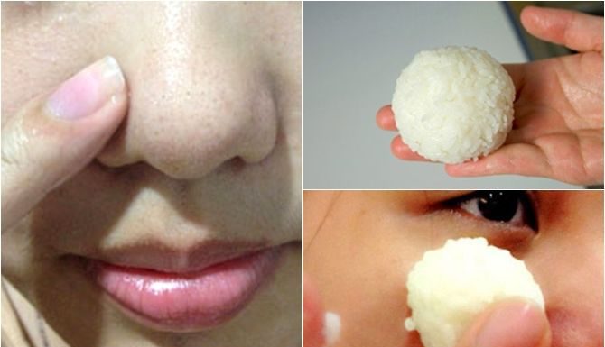 5 MẶT NẠ THIÊN NHIÊN TRỊ MỤN ĐẦU ĐEN TẠI NHÀ, BƯỚC VÀO BẾP LÀ CÓ NGAY CÔNG THỨC 5 MẶT NẠ THIÊN NHIÊN TRỊ MỤN ĐẦU ĐEN TẠI NHÀ, BƯỚC VÀO BẾP LÀ CÓ NGAY CÔNG THỨC