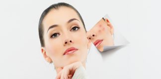 6 điều nên làm khi da nổi mụn