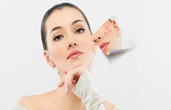 6 điều nên làm khi da nổi mụn 6 điều nên làm khi da nổi mụn