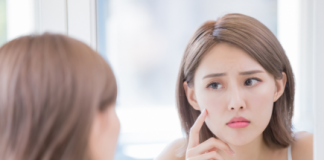 Cách trị dứt điểm mụn ẩn hai bên má