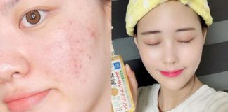 Dùng dầu tẩy trang mà mụn nổi ồ ạt: Sản phẩm không có tội, lỗi là do bạn không biết cách dùng