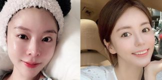Để làn da lột xác thực sự với serum vitamin C không phải chuyện dễ, bạn cần chú ý 5 điều này mới được