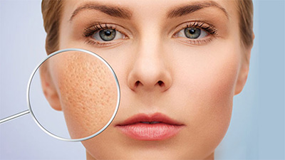 Để tránh nám da, các chị em cần nhớ ngay những “nguyên tắc vàng” này Để tránh nám da, các chị em cần nhớ ngay những “nguyên tắc vàng” này