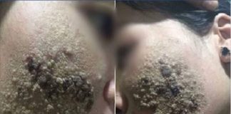 Khuôn mặt nổi từng mảng vì mê làm đẹp nhưng không rõ nguồn gốc, cô gái khiến CĐM xôn xao