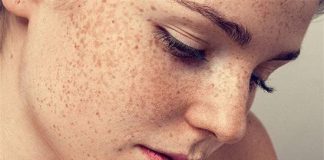 Lấy trứng gà về, trộn đều với 2 thứ này, nám, tàn nhang nặng đến đâu cũng trị khỏi
