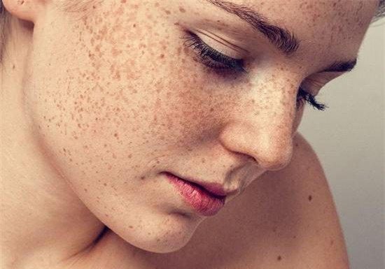 Lấy trứng gà về, trộn đều với 2 thứ này, nám, tàn nhang nặng đến đâu cũng trị khỏi