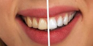 Mách bạn cách làm trắng răng tự nhiên hoàn toàn có thể tự làm mà không tốn một xu đến nha sĩ