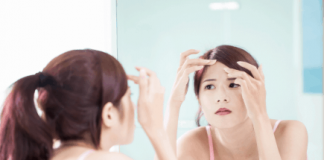 Mụn cám ở trán: Nguyên nhân và cách khắc phục
