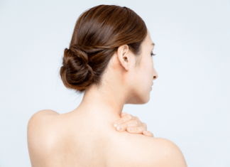 Mụn ở cổ và lưng: Cách điều trị và phòng ngừa