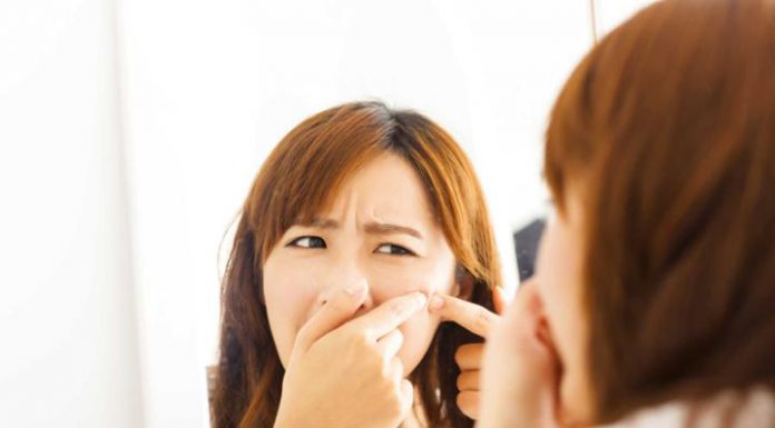 Những thói quen ở tuổi dậy thì cần bỏ để da không vừa rỗ vừa tàn nhang Những thói quen ở tuổi dậy thì cần bỏ để da không vừa rỗ vừa tàn nhang