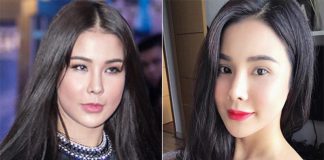 Phẫu thuật thẩm mỹ và những điều cần biết để tránh trở thành thảm họa