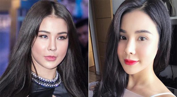 Phẫu thuật thẩm mỹ và những điều cần biết để tránh trở thành thảm họa Phẫu thuật thẩm mỹ và những điều cần biết để tránh trở thành thảm họa