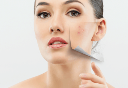 Phương pháp trị mụn nào hợp với bạn? Phương pháp trị mụn nào hợp với bạn?