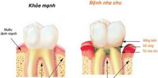 Cô gái 28 tuổi rụng răng, móm mém như cụ bà 80 vì thói quen xấu