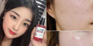 Serum nhầy ốc sên làm đầy sẹo rỗ "hot rần rần", bạn sẽ biết nên mua hay không khi xem loạt review người thật việc thật này
