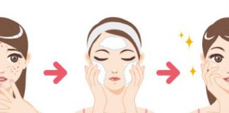 Sữa rửa mặt cho da mụn, chọn sao cho đúng?