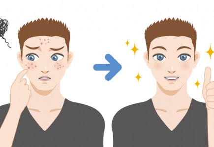 Trị thâm mụn cho nam cách nào? Trị thâm mụn cho nam cách nào?