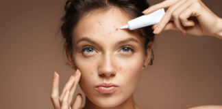 Trị dứt điểm mụn viêm không khó