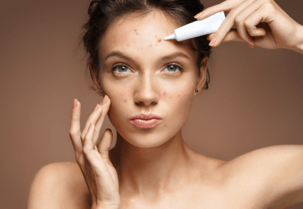 Trị dứt điểm mụn viêm không khó
